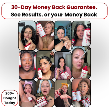 Goodbye Acne Reset Essence